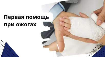 Первая помощь при ожогах